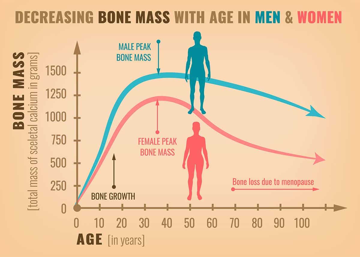 Chart showing decreasing bone mass with age in men and women, highlighting osteoporosis awareness