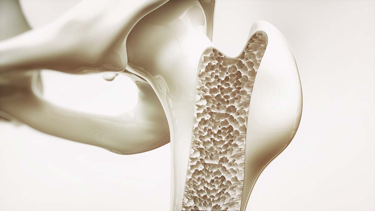 Close-up of bone structure, illustrating the importance of bone health awareness by an osteoporosis advocate